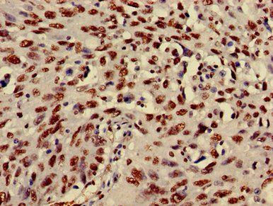 HIST1H3A (Ab-27) Antibody