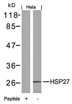 HSP27 (Ab5) Antibody