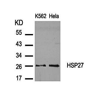 HSP27 (Ab-82) Antibody
