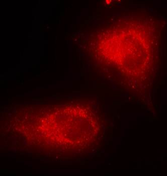 IκB-α (Ab-32/36) Antibody
