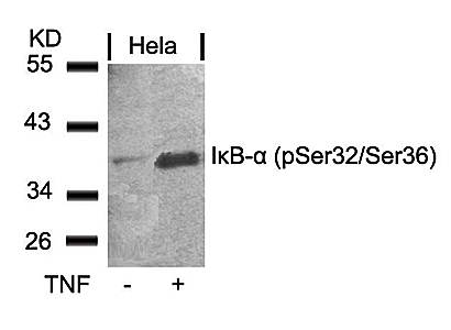IκB-α (Phospho-Ser32/Ser36) Antibody