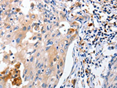 IL18 Antibody