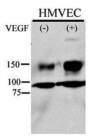 VEGFR2 (phospho-Tyr996) antibody
