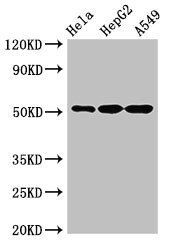 KRT7 antibody