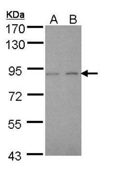 LIM kinase 2 antibody