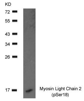 Myosin Light Chain 2 (Phospho-Ser19) Antibody
