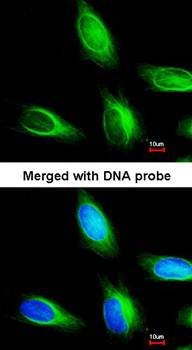 myotubularin related protein 4 antibody