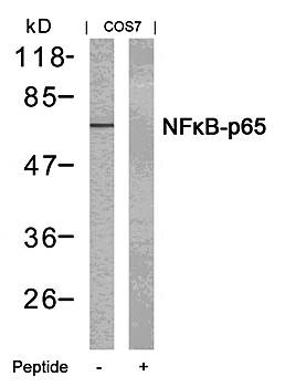 NFκB -p65 (Ab-435) Antibody