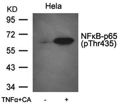 NFκB-p65(Phospho-Thr435) Antibody