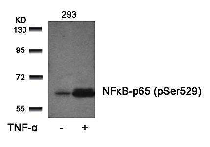 NFκB-p65 (Phospho-Ser529) Antibody