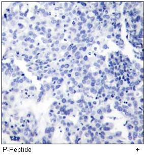 NFκB-p65 (Phospho-Thr505) Antibody