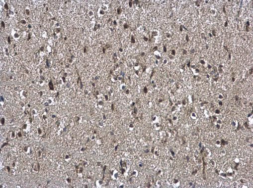 NSFL1 cofactor Antibody