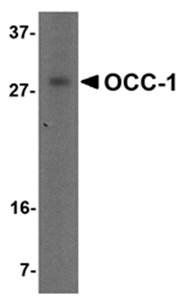 OCC Antibody