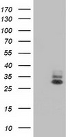 Aquaporin 1 Antibody