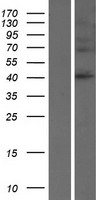 SERPINB8 Human Over-expression Lysate