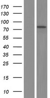 Arginyl tRNA synthetase (RARS) Human Over-expression Lysate