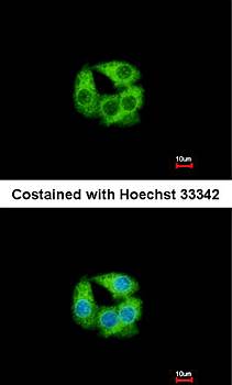PCCase beta antibody