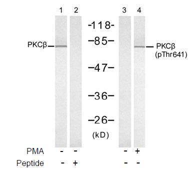 PKCβ (Phospho-Thr641) Antibody