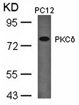 PKCδ (Ab-645) Antibody