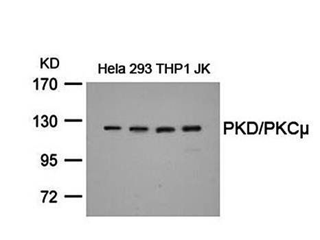 PKD/PKCμ (Ab-738) Antibody