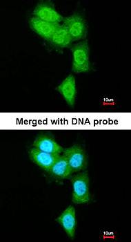 PSMB8 antibody