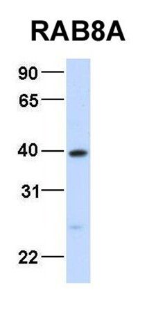RAB8A antibody