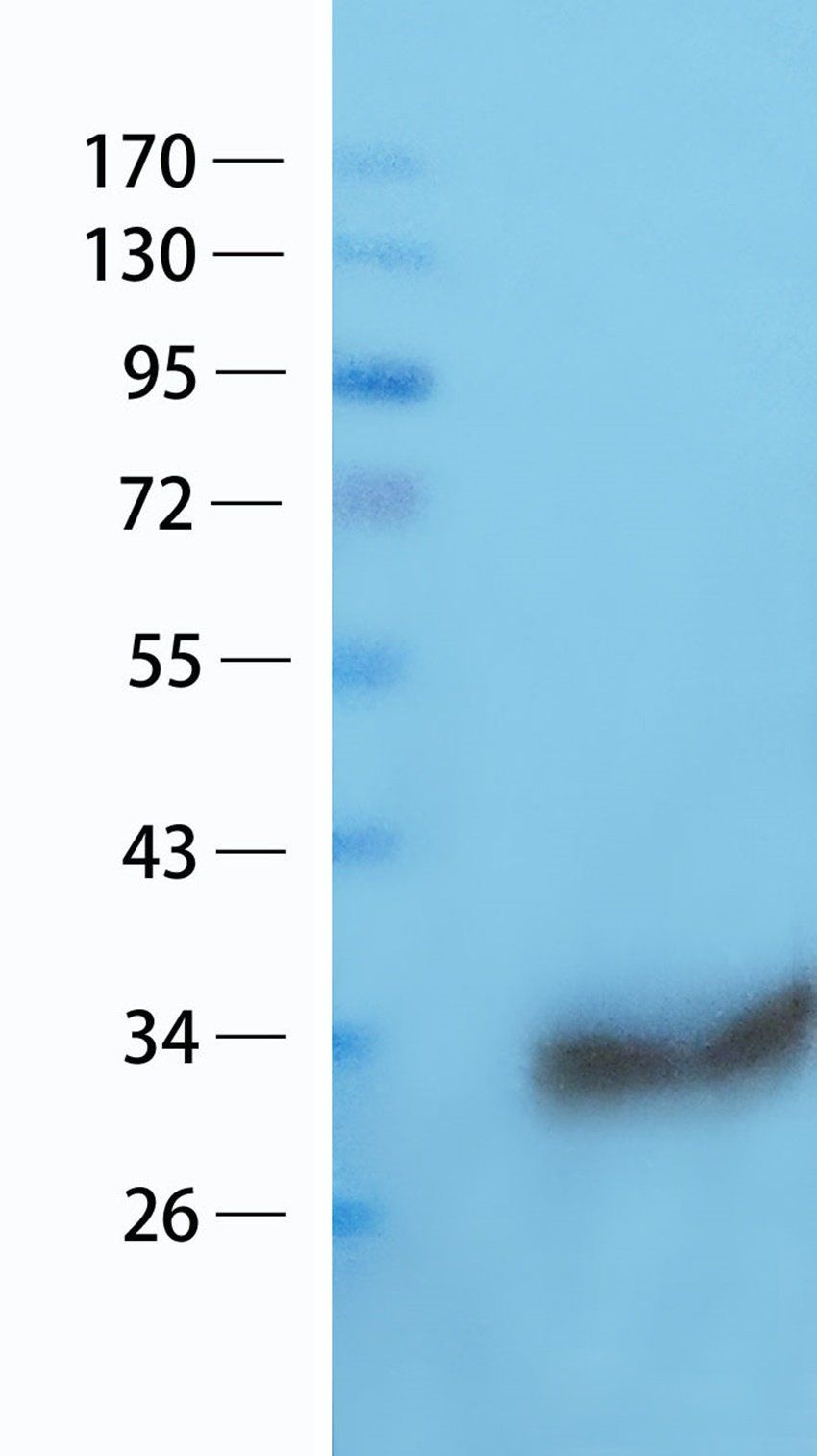 RANTES antibody