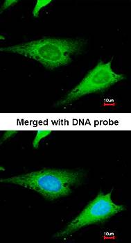 ribosomal protein S3a antibody