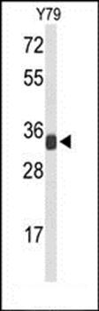 RPL5 antibody
