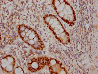 SOX9 Antibody