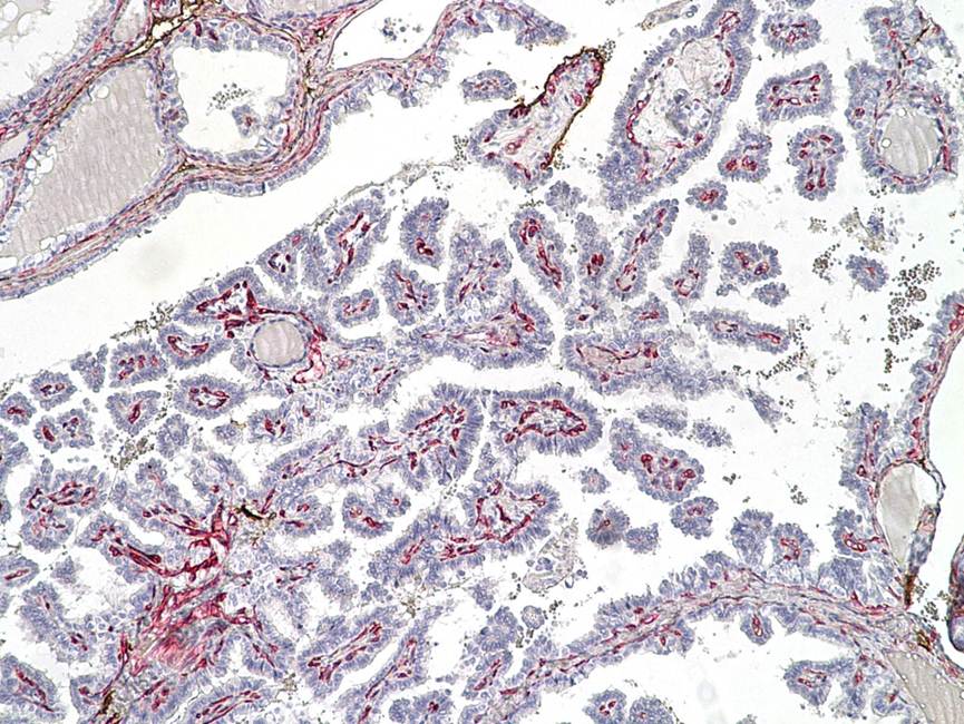 sVEGFR2 antibody