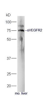 sVEGFR2 antibody