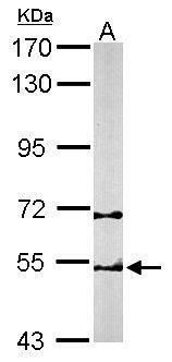 TCP1 beta antibody