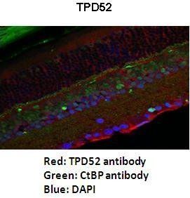 TPD52 antibody