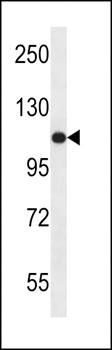 USO1 antibody