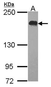USP47 antibody
