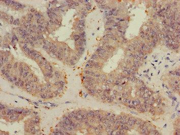 VEGFB Antibody