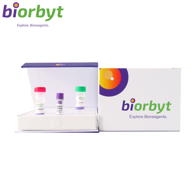 Anti-YY1 Antibody Picoband (monoclonal, 3F3E7)